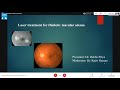 Laser treatment for diabetic macular edema dr  rekha priya 27 may 2021