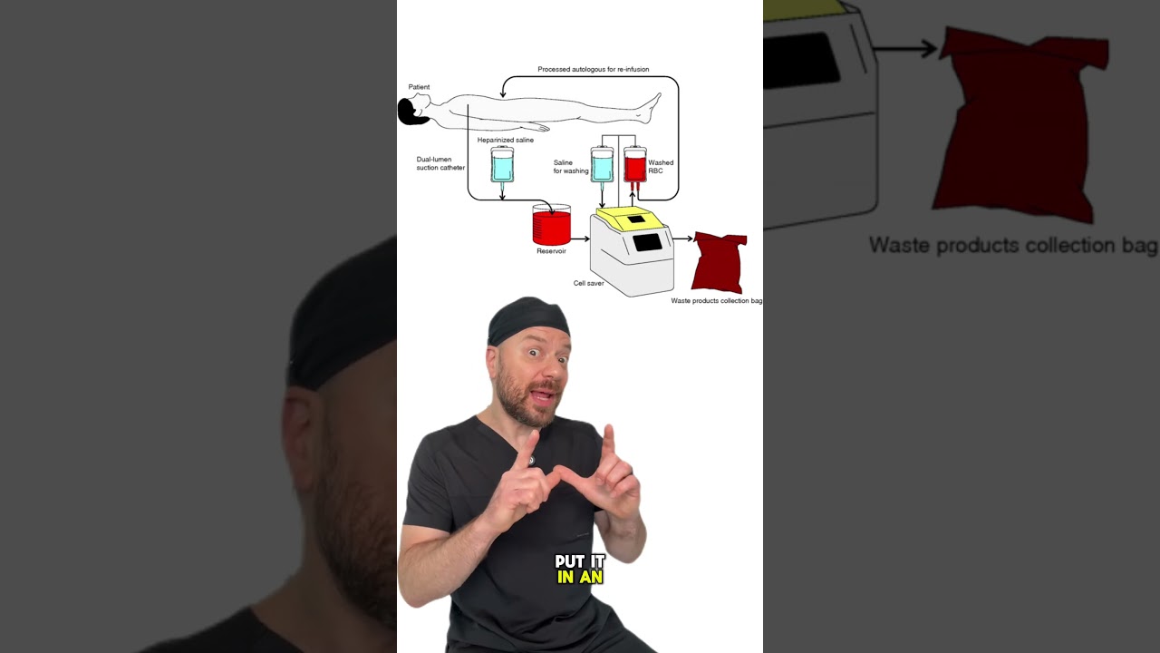 Cell Saver isn’t just a machine — it’s a safety net. 🩸