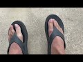 #4 - 4 Weeks Post-Surgery - Cheilectomy Surgery - Patient Recovery &amp; Review  Hallux Rigidus Big Toe