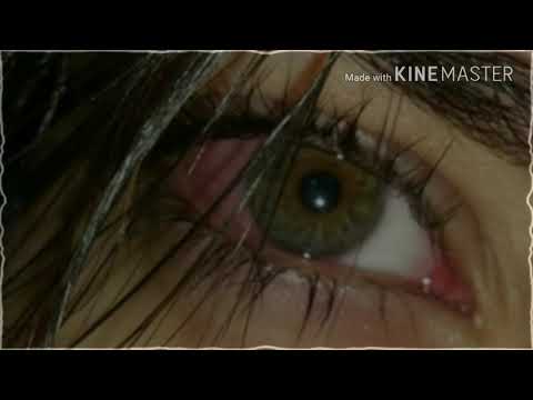 اغنيه جرحي لا ينزف ولا يتوقف اغنيه تركيه روووعه 