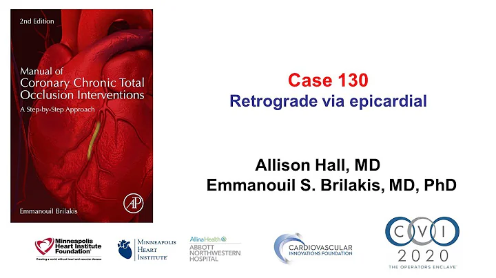 Case 130: Manual of CTO interventions - Retrograde via epicardial troubleshooting