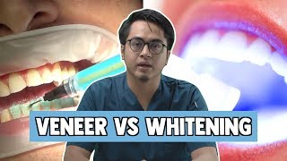 Veneer vs Whitening