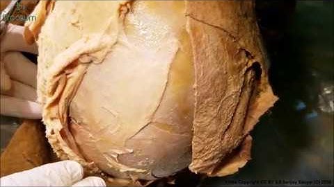 Cadaveric Anatomy of The Scalp: Layers, Innervation, Blood Supply (Human Anatomy Dissection videos)