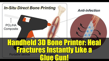 Handheld 3D Bone Printer: Heal Fractures Instantly Like a Glue Gun!