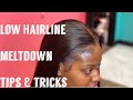 *NEW* Small Forehead Frontal MELTDOWN (Sew in) Tips and Tricks