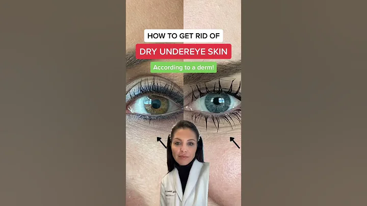 How to get rid of dry under eye wrinkles according to a dermatologist #shorts