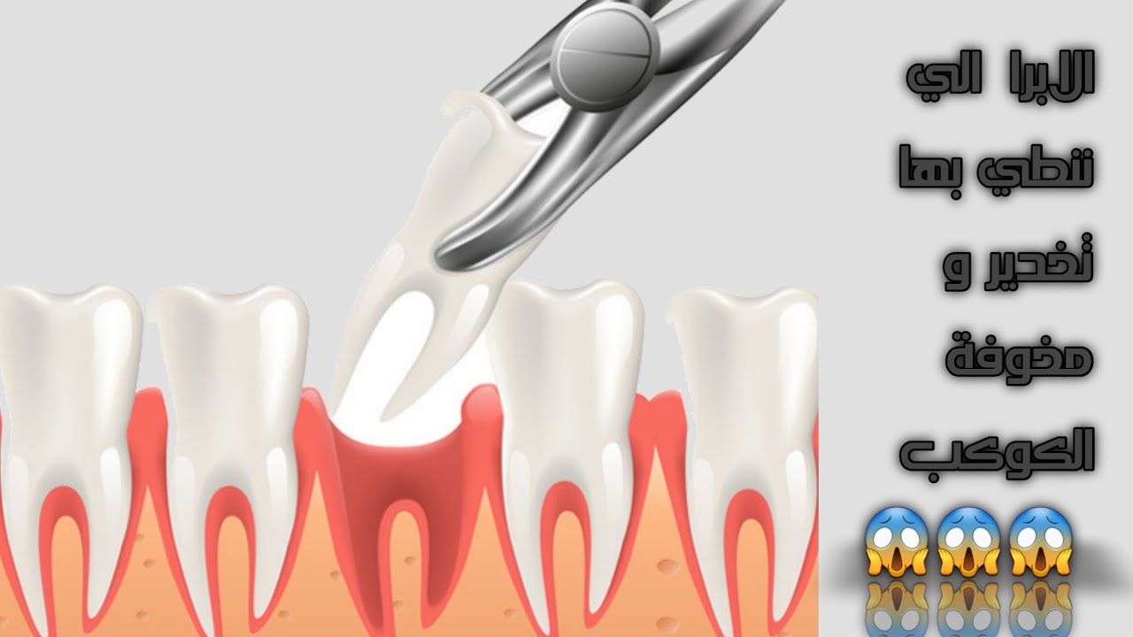 Instruments of Local Anesthesia الابرا الي مخوفة الكوكب 😱😱؟؟