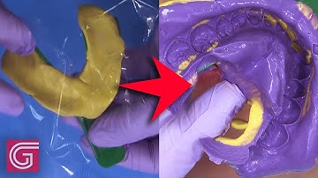 How to Take a Two-Step Impression