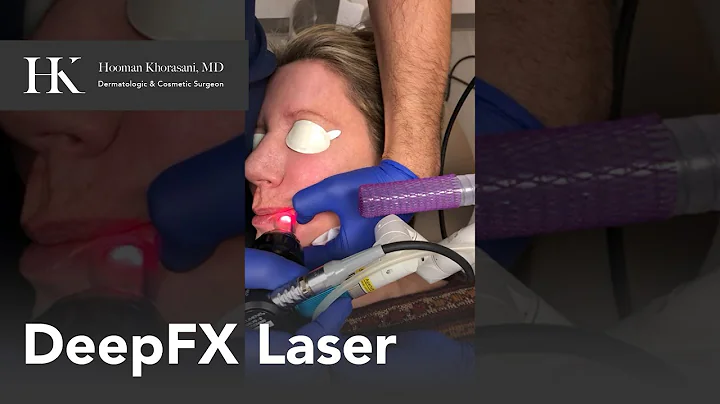 DeepFX performed by Dr. Hooman Khorasani