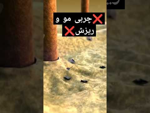 عوامل ریزش مو و راهکار های درمانی