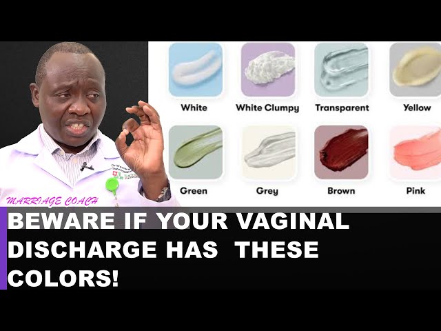 WHAT IS THE COLOR OF YOUR VAGINAL DISCHARGE? IS IT CLEAR, WHITE