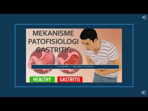 MEKANISME PATOFISIOLOGI GASTRITIS