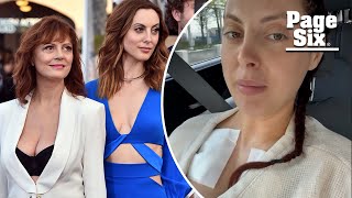 Susan Sarandon’s daughter, Eva Amurri, undergoes plastic surgery