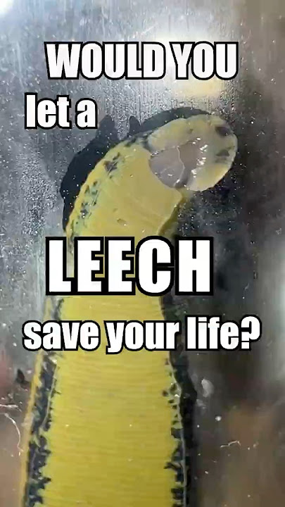 Why Are Leeches Used In Medicine?