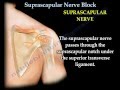 Shoulder Pain Injection Suprascapular Nerve Block - Everything You Need To Know - Dr. Nabil Ebraheim