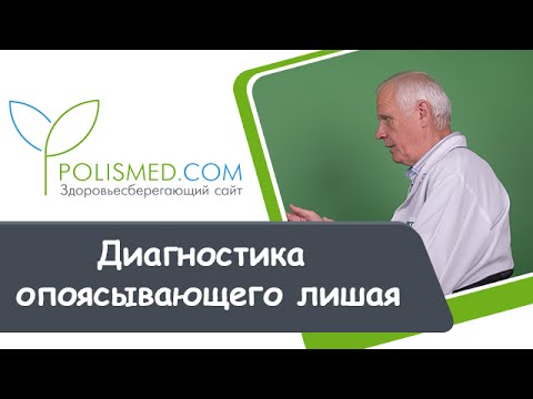 Диагностика опоясывающего лишая