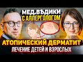 Атопический дерматит