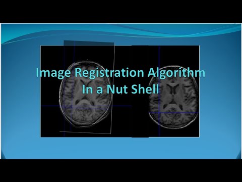 Image Registration In a Nutshell E[5.1]