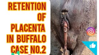 Retention Of Placenta In Buffalo Case No2 Retained Fetal Membranes