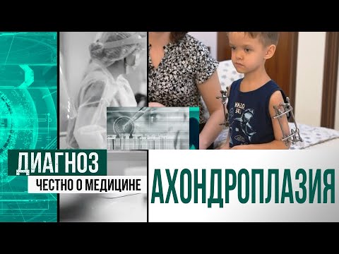 Принять и ломать? Как живут дети с ахондроплазией в Казахстане | Диагноз