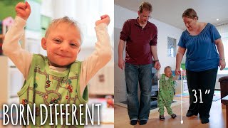 Tiny 31-Inch Boy With Primordial Dwarfism Defies Doctors | BORN DIFFERENT