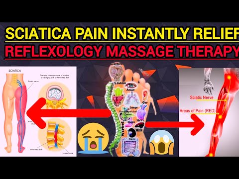SCIATICA PAIN INSTANTLY RELIEF TREATMENT !!BY REFLEXOLOGY MASSAGE THERAPY !! DR .P. Choudhary!!#live