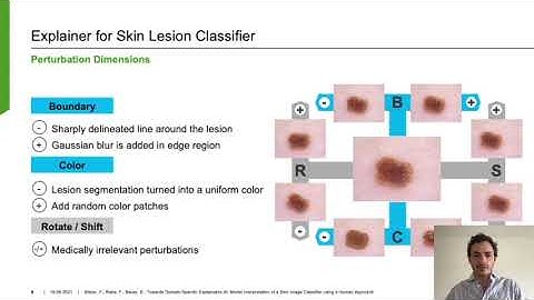 Towards Domain-Specific Explainable AI: Model Interpretation of a Skin Image Classifier (Teaser)