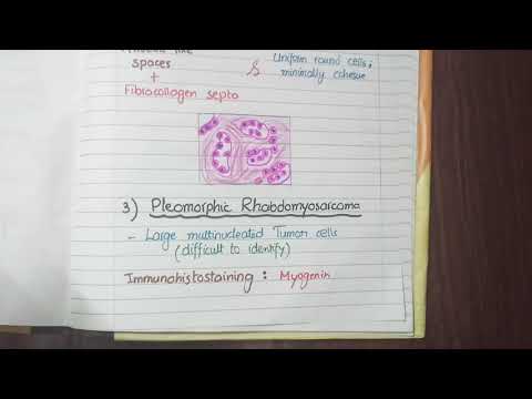 Rhabdomyosarcoma Pathology