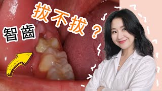 「還有智齒的必看」拔完臉會變小嗎牙齒變擁擠超級痛打破智齒迷思 @DrTeresa