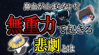 【ゆっくり解説】鼻血が止まらない!?無重力で起きる悲劇とは一体