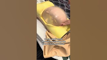 How we flip a breech baby! #shorts #obgyn #breech #simulator