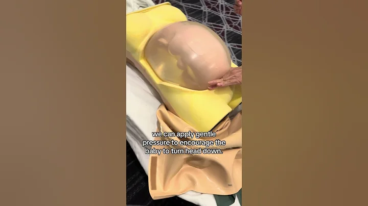 How we flip a breech baby! #shorts #obgyn #breech #simulator
