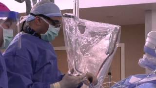 Opening Blocked Arteries In The Leg