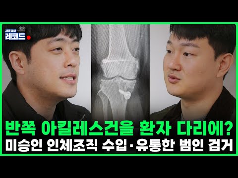 🔴반쪽짜리 미승인 아킬레스건을 <strong>환자</strong> 다리에?🎬서울경찰 레코드 <strong>EP</strong>. 41