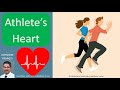 Athletes heart