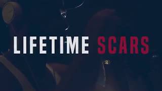 Sawed Off - Lifetime Scars (Official Video)