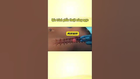 Quá trình phẫu thuật nâng ngực #cothebanchuabiet #khoahoc #khampha