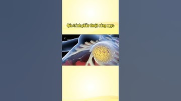 Quá trình phẫu thuật nâng ngực #cothebanchuabiet #khoahoc #khampha