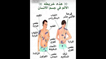 خريطة الألم في جسم الإنسان 