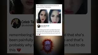 Celebrity Megan Fox Shuts Down Botox Rumors… But Fans Feel Heartbroken 💔 Wealth