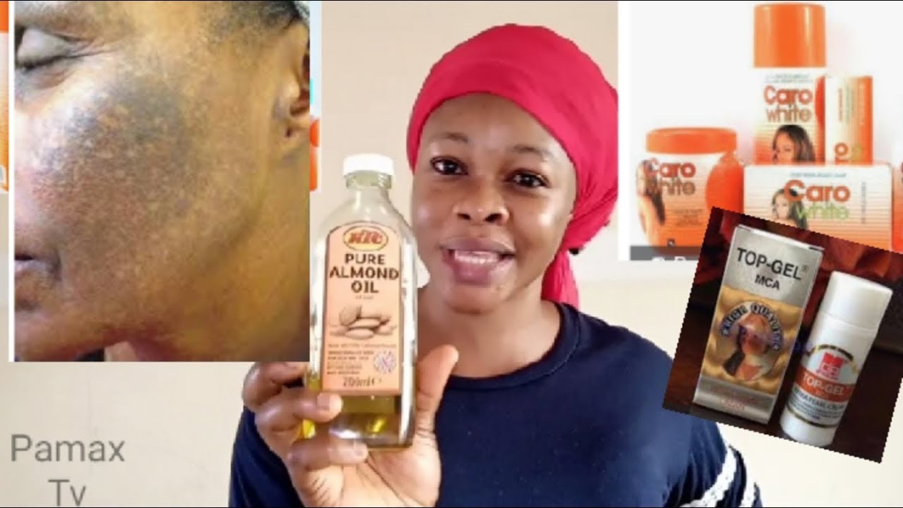 In 3 Days Remove Bleaching Cream Reaction Using Almond Oil YouTube