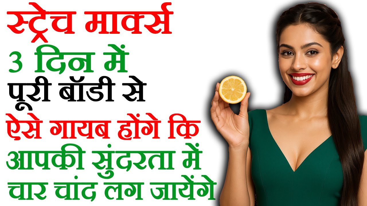 Stretch marks and their treatment in Hindi Video foto foto Stretch marks and their treatment in Hindi Video