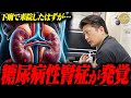 「腎臓が萎縮している!?」下痢に苦しみ来院した患者だったが… まさかの糖尿病による腎臓の障害まで発覚!?