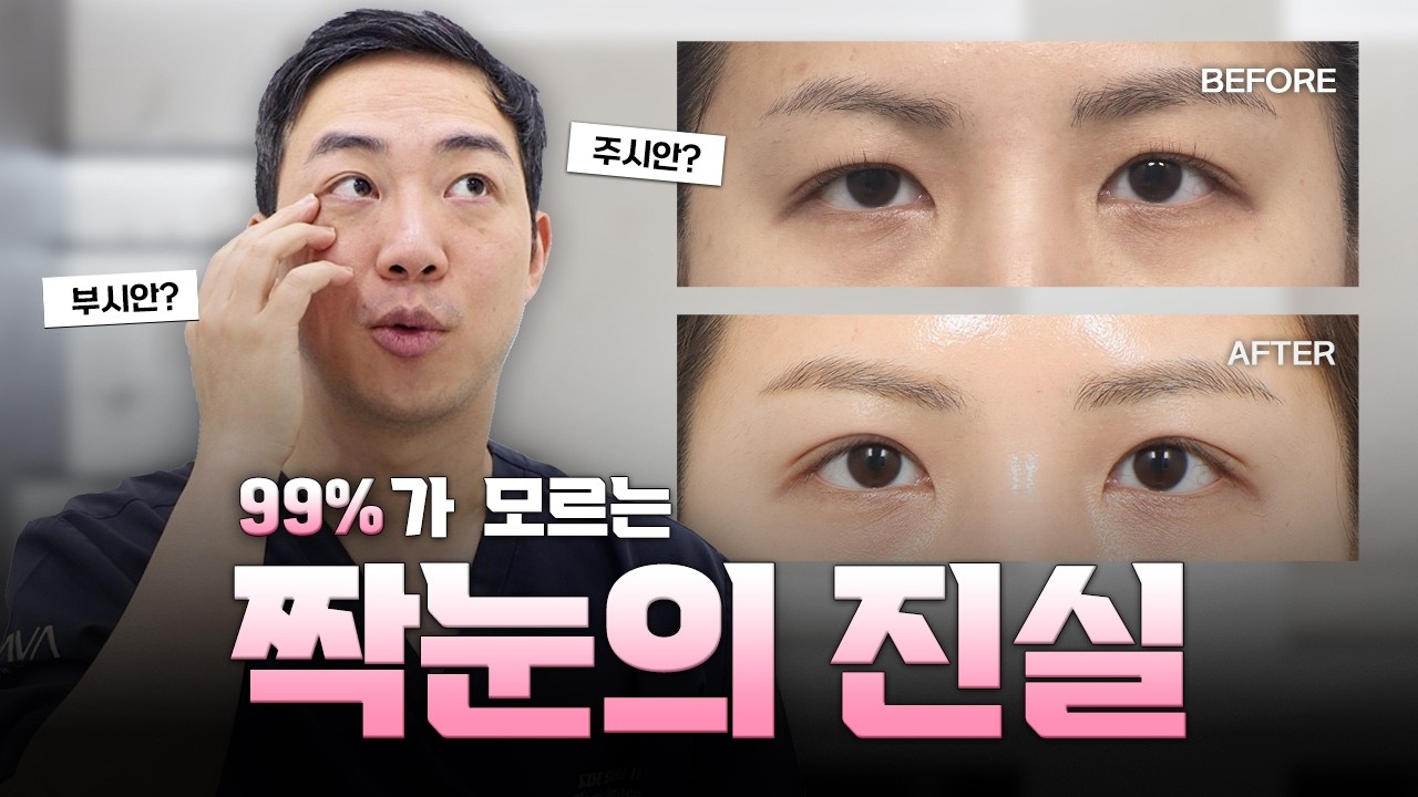 짝눈인 줄 알았는데 아니라고?😮 | 성형외과 의사가 말하는 '진짜' 짝눈💥