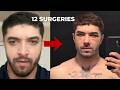 The Average Guy Needs 20 SURGERIES To Ascend
