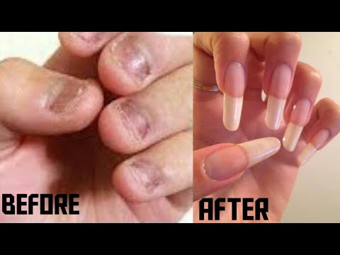 How to grow long Nails really Very Fast in 7 days