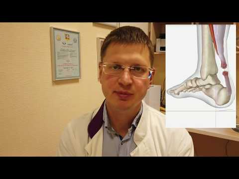 Видео: Лучевая терапия при тромбе опухоли нижней полой вены у пациентов с гепатоцеллюлярной карциномой