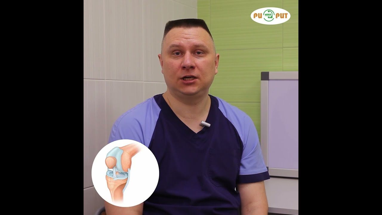 Все о растяжении крестообразной связки колена за 1 мин