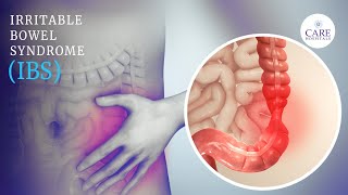 Irritable bowel syndrome (IBS) Symptoms and causes | CARE Hospitals