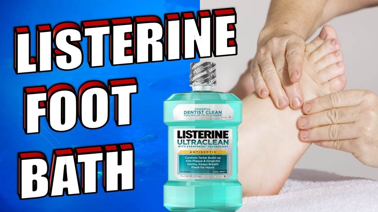 DIY Listerine Dead Skin Remover Foot Soak - STOCKPILING MOMS™